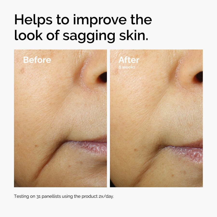 caffeine-3-escin-1-face-serum-c6 ord-caffeine-3pct-escin-1pct-face-serum-before-after-sagging.jpg