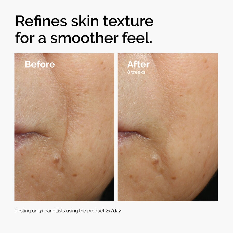 caffeine-3-escin-1-face-serum-c6 ord-caffeine-3pct-escin-1pct-face-serum-before-after-texture.jpg