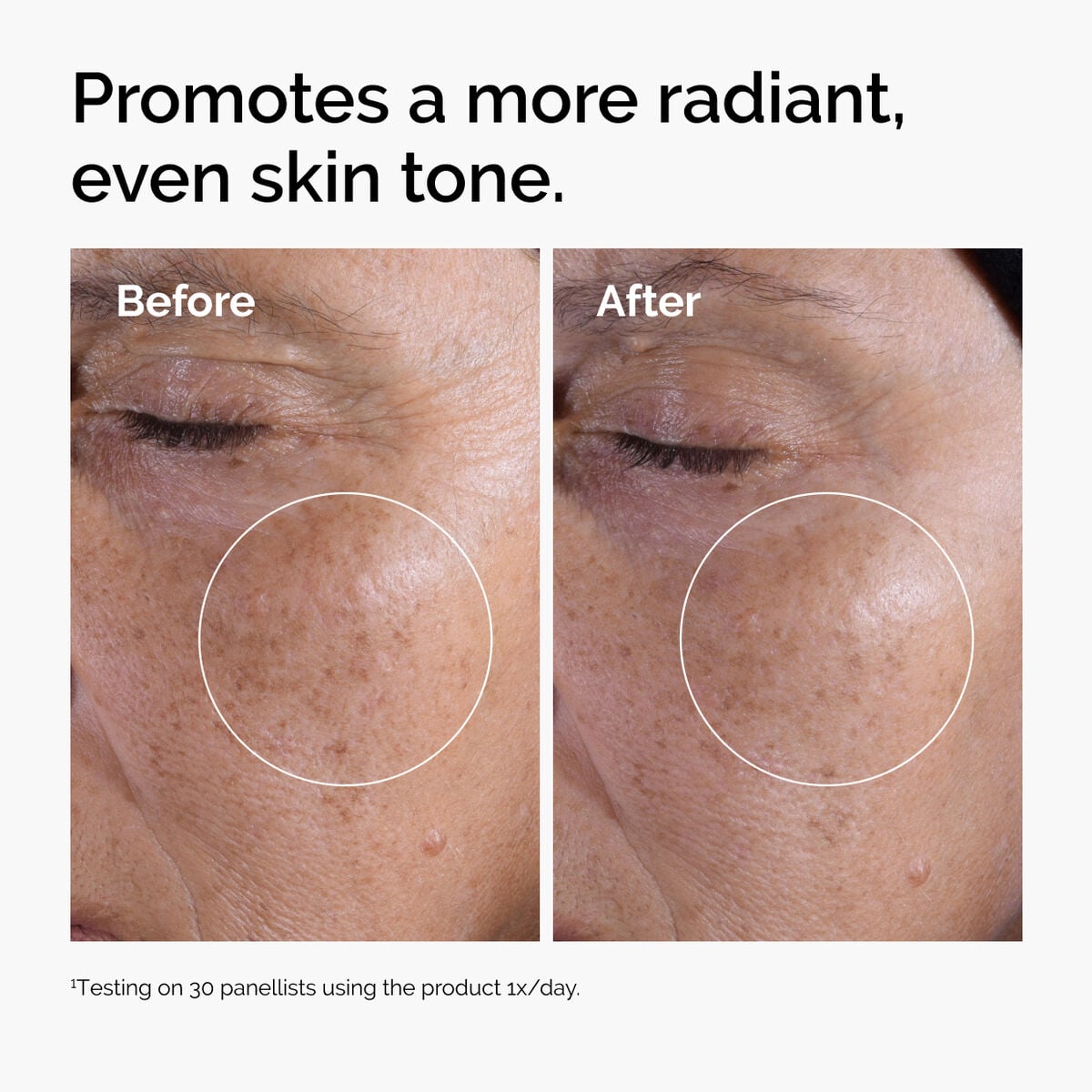 glycolic-acid-7-exfoliating-toner-d8 ord-glycolic-before-after-radiance.jpg