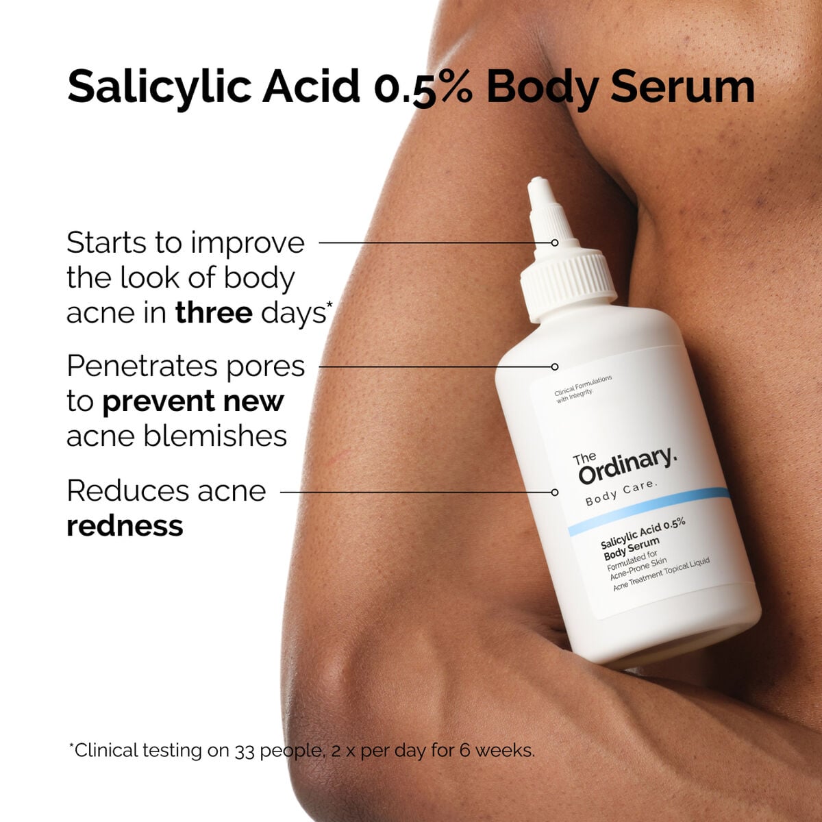 salicylic-acid-0-5-body-serum-s4 ord-salicylic-05-body-serum-otc-benefits-infographic.jpg