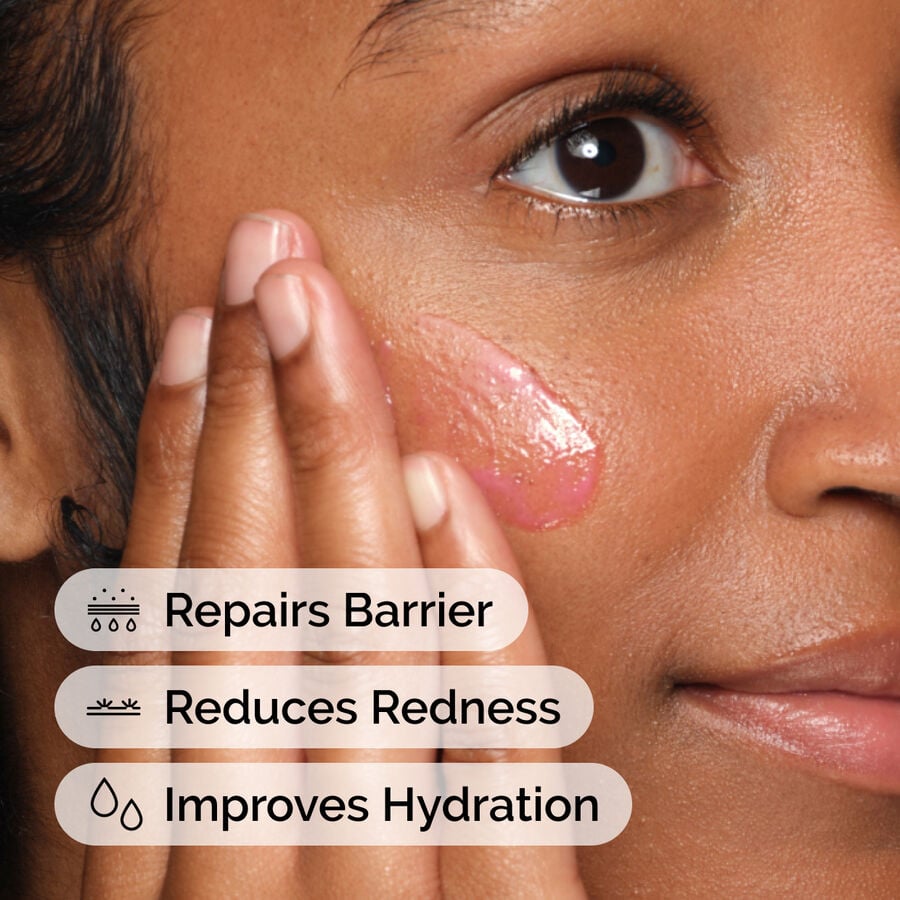 soothing-and-barrier-support-serum-k5 ord-soothing-barrier-support-serum-model-application-with-benefits.jpg